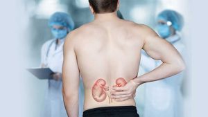 Increase Testosterone Levels and Lower Your Risk of Developing Kidney Disease